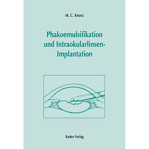 Phakoemulsifikation und Intraokularlinsenimplantation, m. CD-ROM, M. C. Knorz