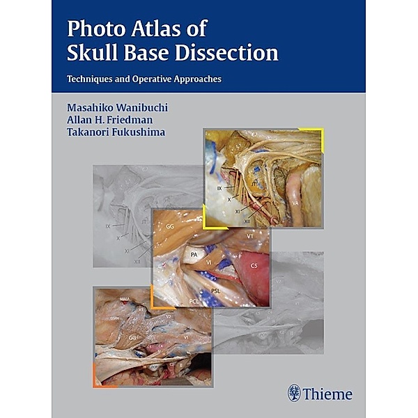 Photo Atlas of Skull Base Dissection, Masahiko Wanibuchi, Allan H. Friedman, Takanori Fukushima
