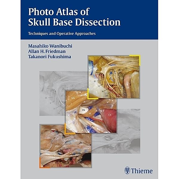 Photo Atlas of Skull Base Dissection, Masahiko Wanibuchi, Allan H. Friedman, Takanori Fukushima