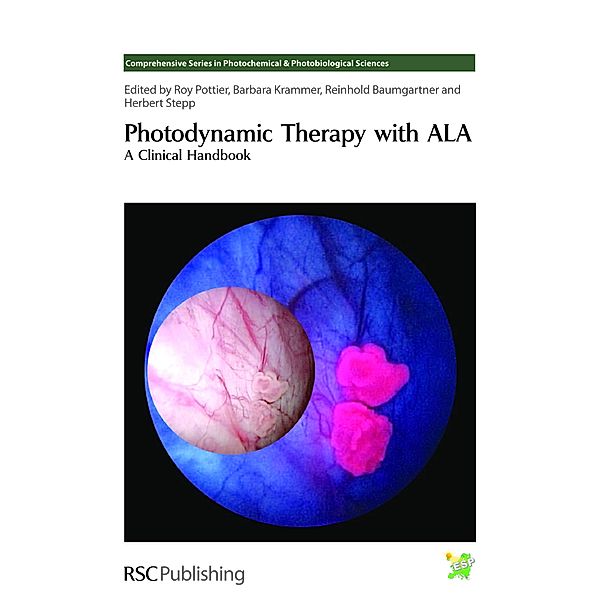 Photodynamic Therapy with ALA / ISSN