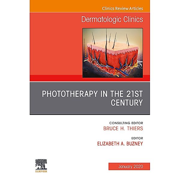 Phototherapy,An Issue of Dermatologic Clinics E-Book