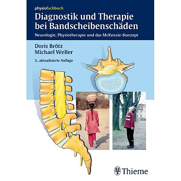 Physiofachbuch: Diagnostik und Therapie bei Bandscheibenschäden, Doris Brötz, Michael Weller