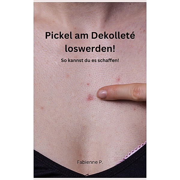 Pickel am Dekolleté loswerden!, Fabienne P.