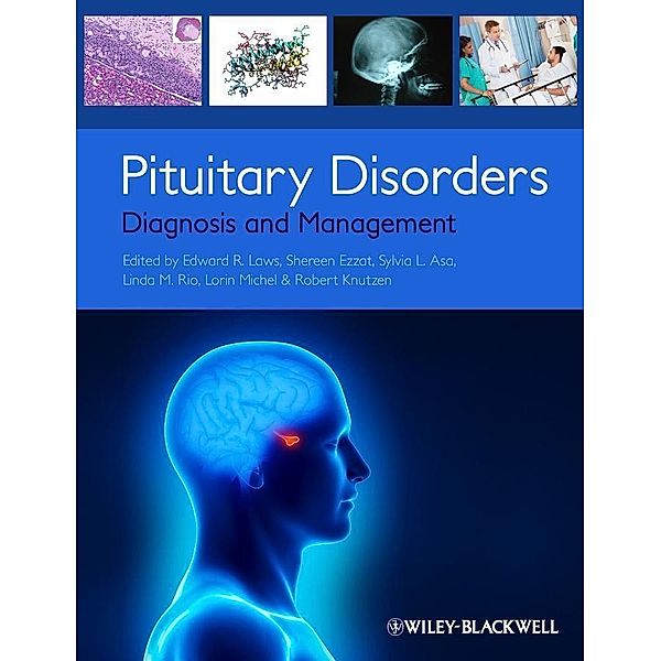 Pituitary Disorders