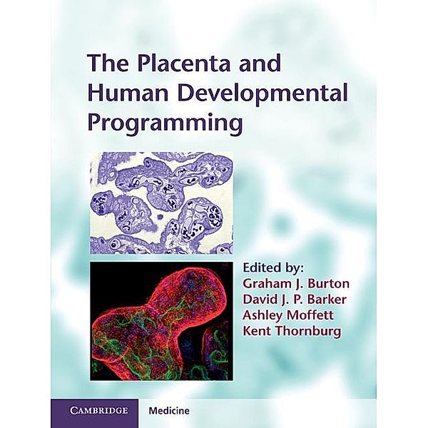 Placenta and Human Developmental Programming