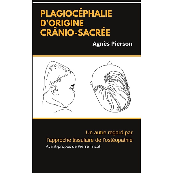 plagiocéphalie d'origine crânio-sacrée, Agnès Pierson