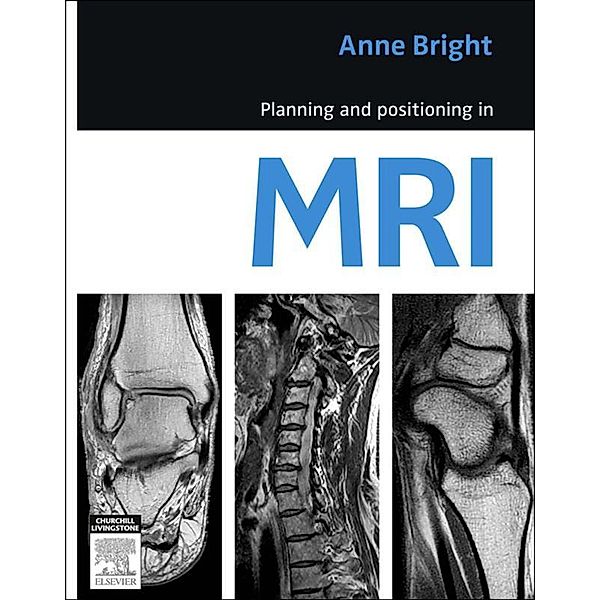 Planning and Positioning in MRI - E-Book, Anne Bright