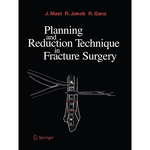 Planning and Reduction Technique in Fracture Surgery, Jeffrey Mast, Roland Jakob, Reinhold Ganz
