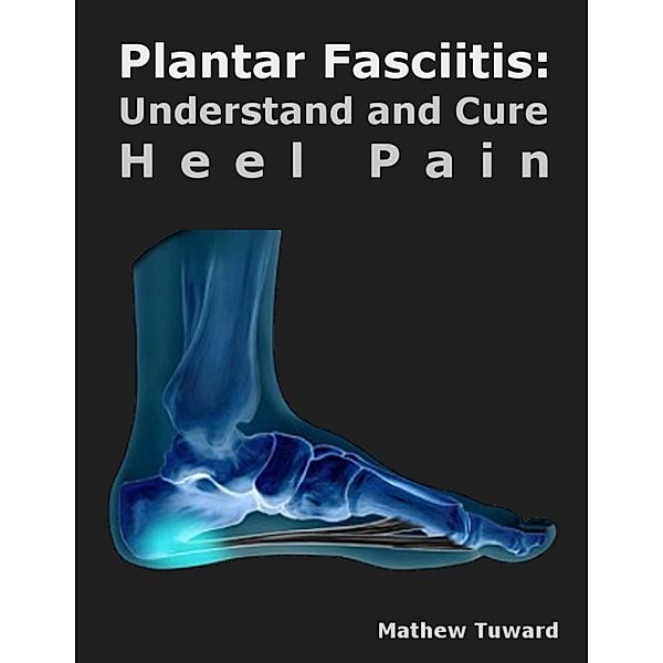 Plantar Fasciitis: Understand and Cure Heel Pain, Mathew Tuward