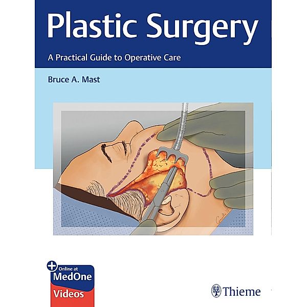 Plastic Surgery: A Practical Guide to Operative Care, Bruce A. Mast