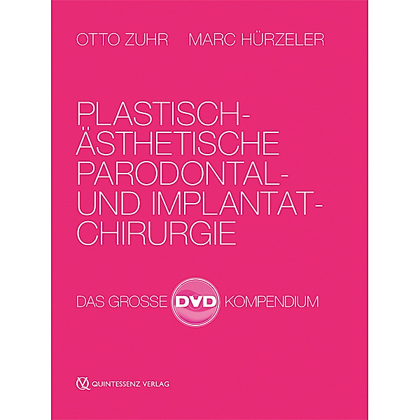 Plastisch-Ästhetische Parodontal- und Implantatchirurgie,4 DVD-Video, Otto Zuhr, Marc Hürzeler