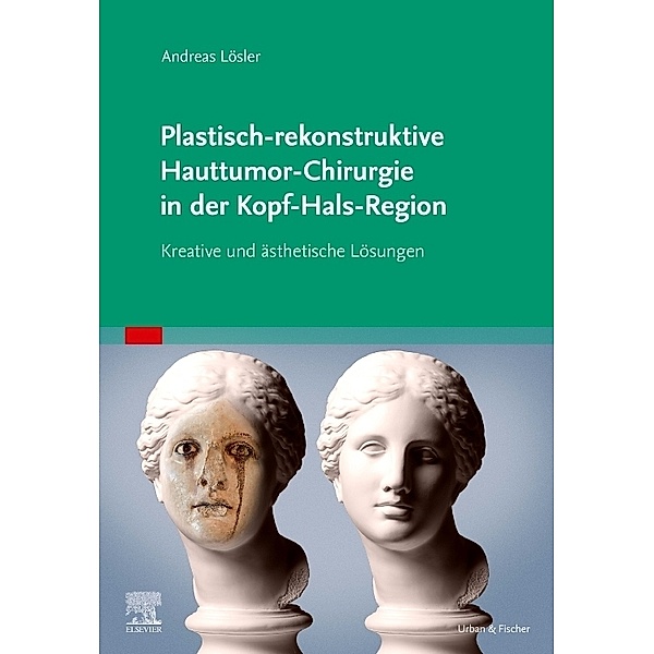 Plastisch-rekonstruktive Hauttumor-Chirurgie in der Kopf-Hals-Region, Andreas Lösler