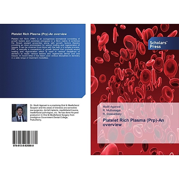 Platelet Rich Plasma (Prp)-An overview, Mudit Agarwal, R. Muthunagai, R. Sivasankary