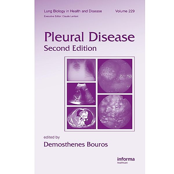 Pleural Disease