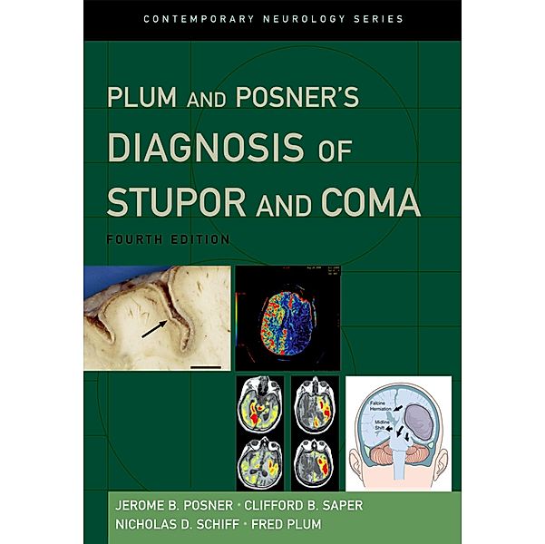 Plum and Posner's Diagnosis of Stupor and Coma / Contemporary Neurology Series, Jerome B. M. D. Posner, Clifford B. M. D. Saper, Nicholas M. D. Schiff, Fred M. D. Plum