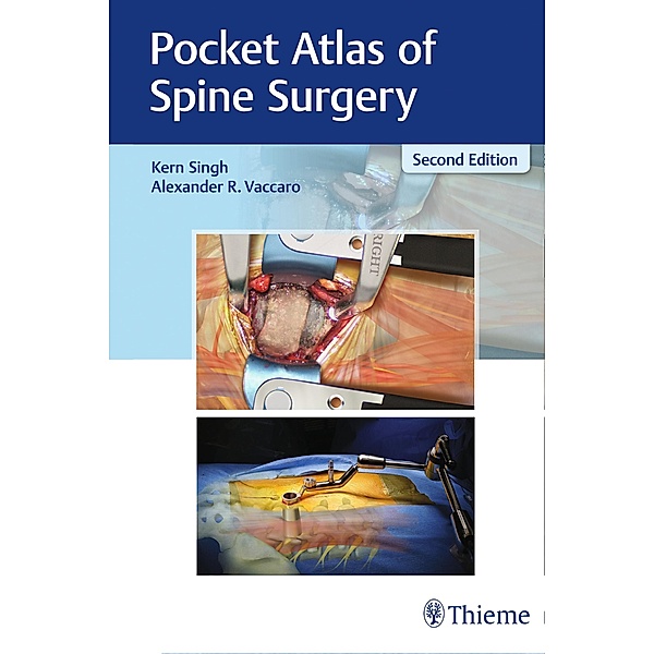 Pocket Atlas of Spine Surgery, Kern Singh, Alexander Vaccaro