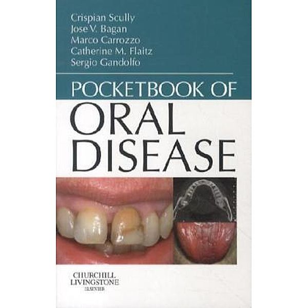 Pocketbook of Oral Disease, Crispian, CBE Scully, Jose Vicente Bagan Sebastian, Marco Carrozzo, Catherine M. Flaitz, Sergio Gandolfo