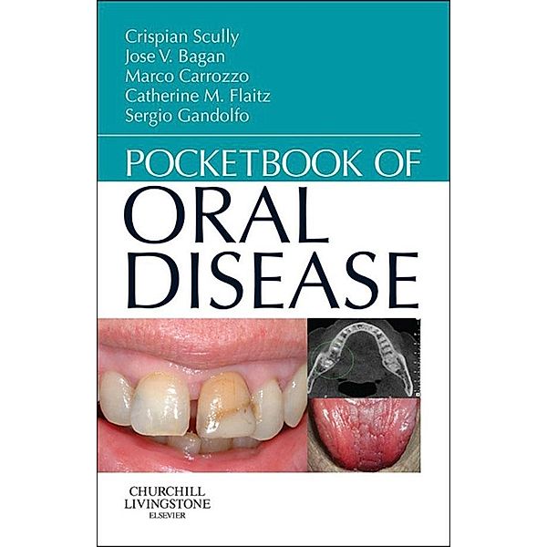 Pocketbook of Oral Disease - E-Book, Crispian Scully, José Vicente Bagán Sebastián, Marco Carrozzo, Catherine M Flaitz, Sergio Gandolfo