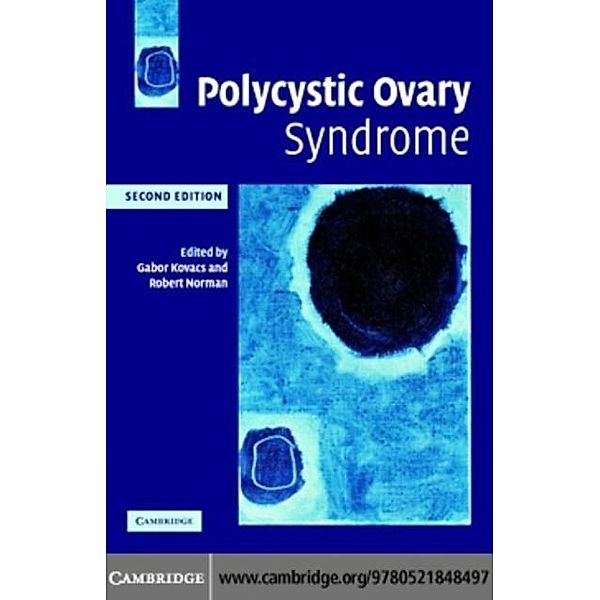 Polycystic Ovary Syndrome