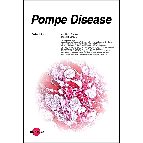 Pompe Disease / UNI-MED Science, Arnold J. J. Reuser, Benedikt Schoser