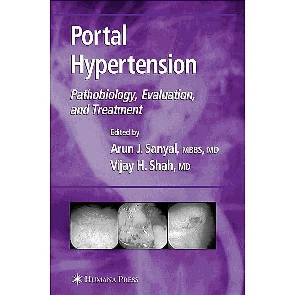 Portal Hypertension