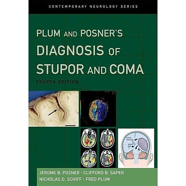 Posner, J: Plum and Posner's Diagnosis of Stupor and Coma, Jerome B. Posner, Clifford B. Saper, Nicholas Schiff, Fred Plum
