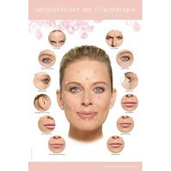 Poster - Möglichkeiten der Fillertherapie