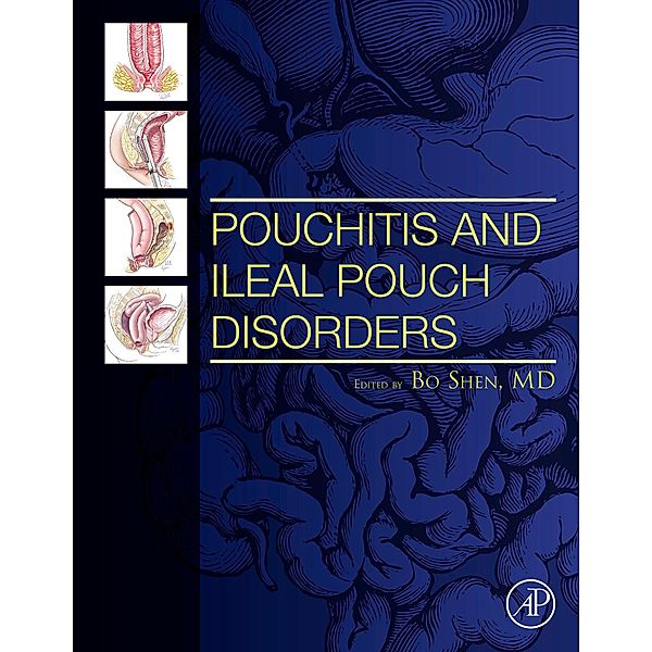 Pouchitis and Ileal Pouch Disorders