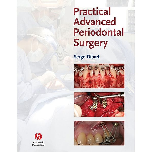 Practical Advanced Periodontal Surgery, Serge Dibart