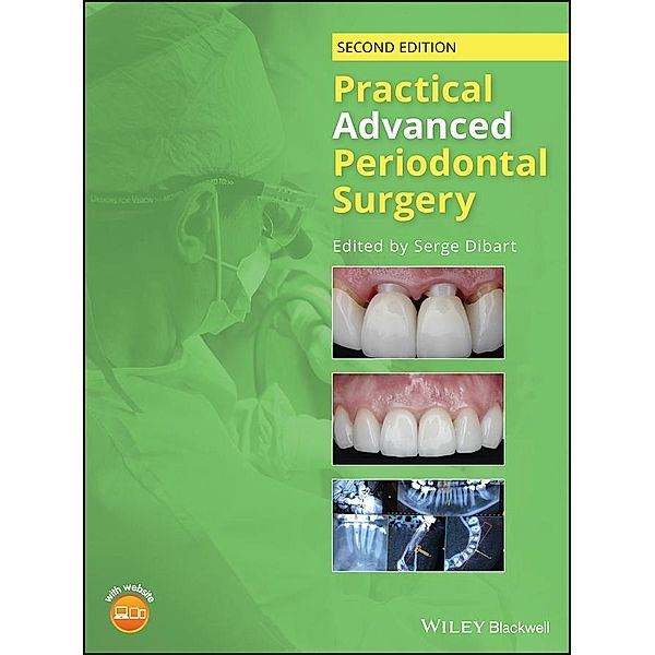 Practical Advanced Periodontal Surgery, Serge Dibart