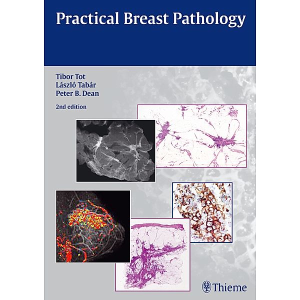 Practical Breast Pathology, Tibor Tot, Laszlo Tabar, Peter B. Dean