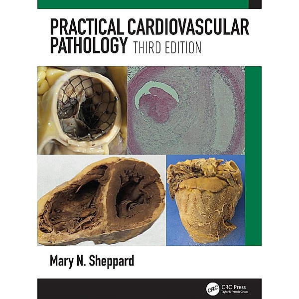 Practical Cardiovascular Pathology, Mary N. Sheppard