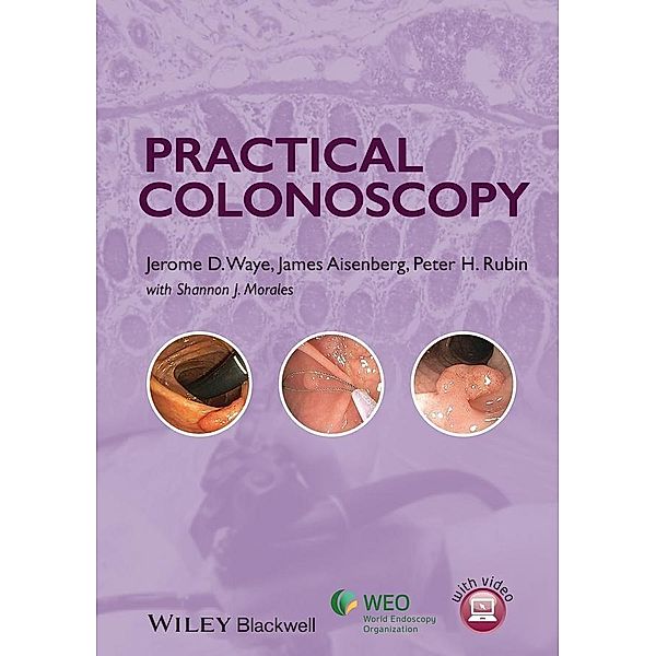 Practical Colonoscopy, Jerome D. Waye, James Aisenberg, Peter H. Rubin, Shannon J. Morales