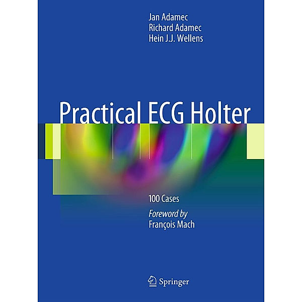 Practical ECG Holter