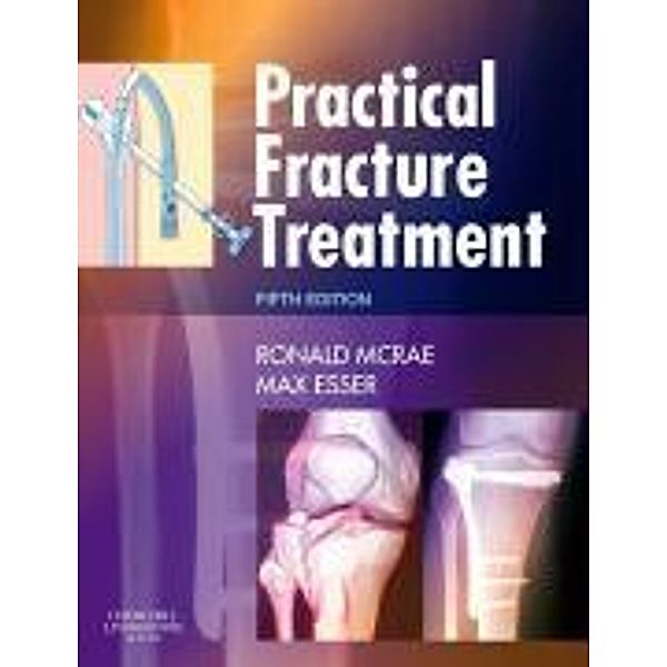 Practical Fracture Treatment, Ronald McRae, Max Esser