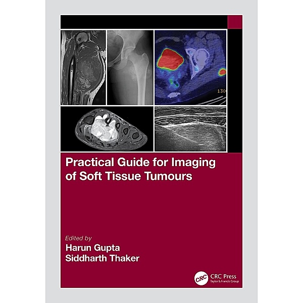 Practical Guide for Imaging of Soft Tissue Tumours