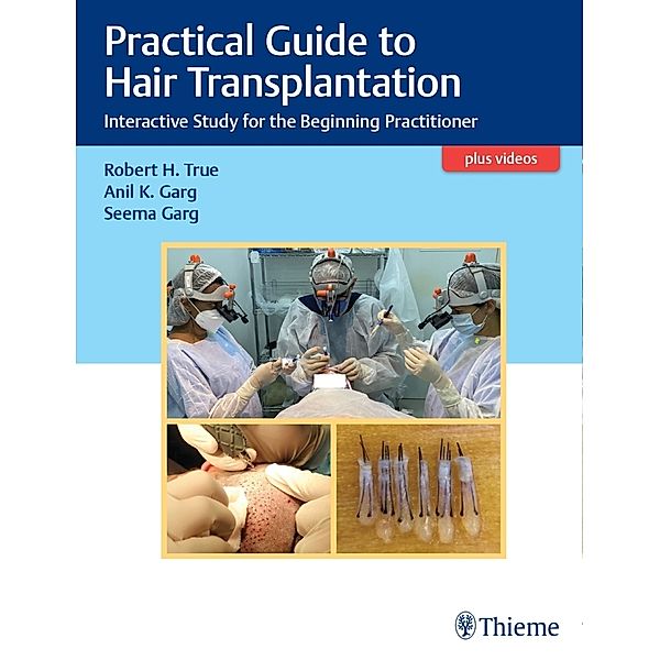 Practical Guide to Hair Transplantation, Robert True, Anil Garg, Seema Garg