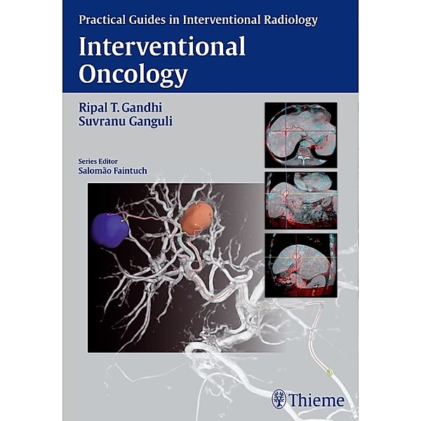 Practical Guides in Interventional Radiology / Interventional Oncology, Ripal T. Gandhi, Suvranu Ganguli