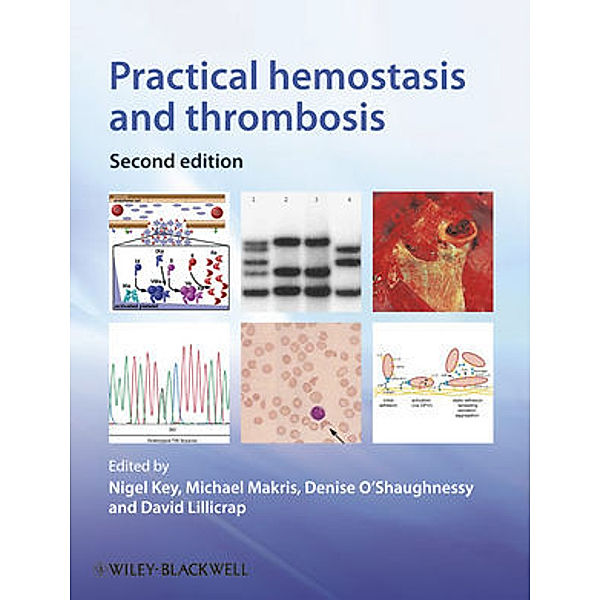 Practical Hemostasis and Thrombosis, Nigel Key, Michael Makris, Denise O'Shaughnessy, David Lillicrap