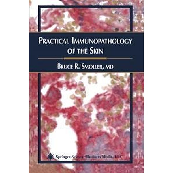 Practical Immunopathology of the Skin / Current Clinical Pathology, Bruce R. Smoller