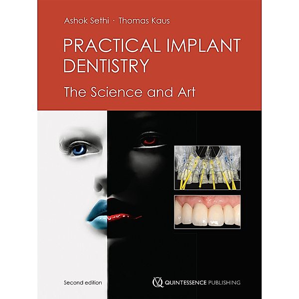 Practical Implant Dentistry, Ashok Sethi, Thomas Kaus