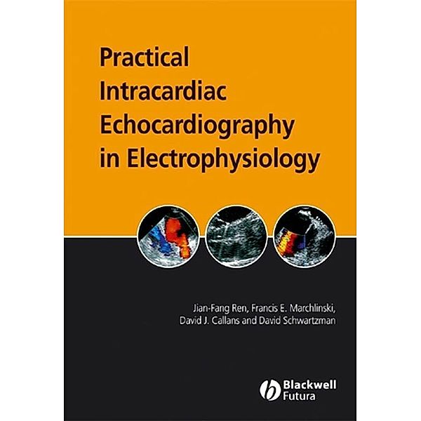 Practical Intracardiac Echocardiography in Electrophysiology, Jian-Fang Ren, Francis E. Marchlinski, David J. Callans, David Schwartsman