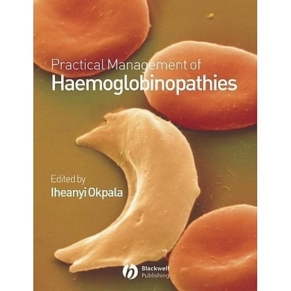 Practical Management of Haemoglobinopathies