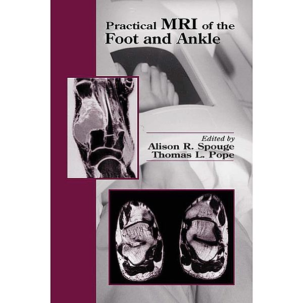 Practical MRI of the Foot and Ankle