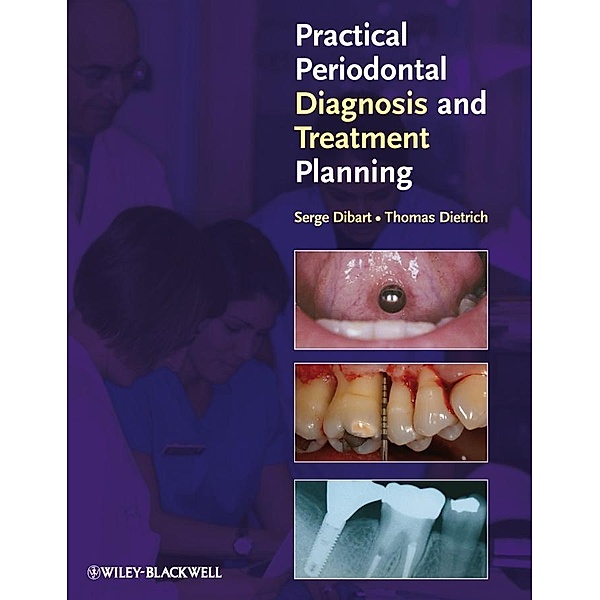 Practical Periodontal Diagnosis and Treatment Planning, Serge Dibart