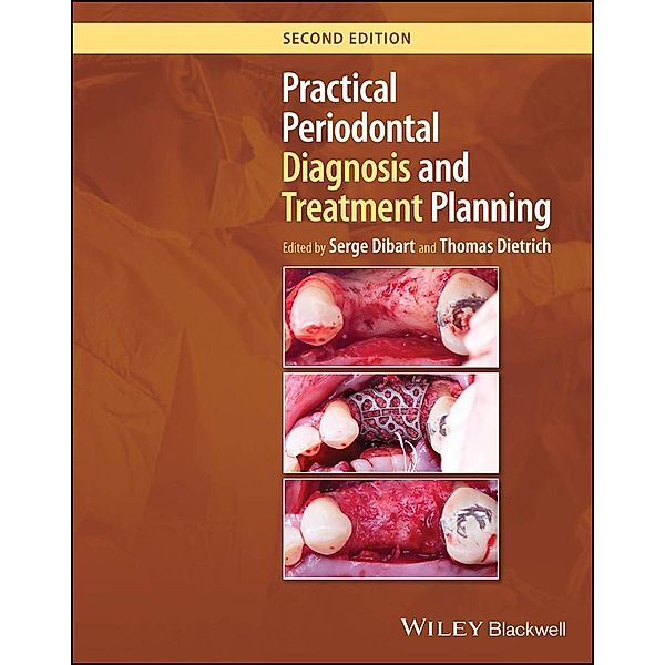 Practical Periodontal Diagnosis and Treatment Planning