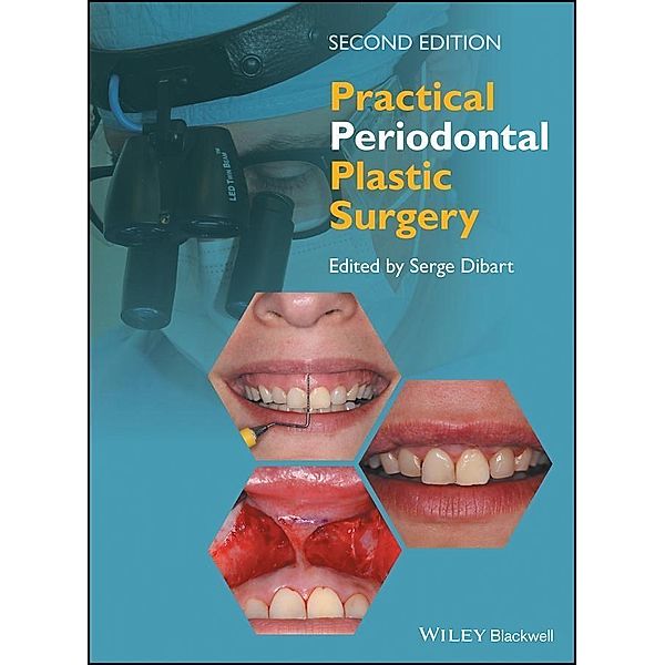 Practical Periodontal Plastic Surgery