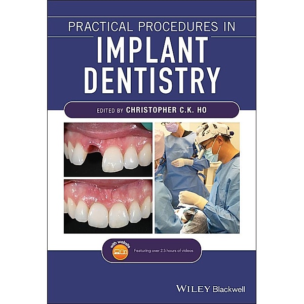 Practical Procedures in Implant Dentistry, Christopher C. K. Ho