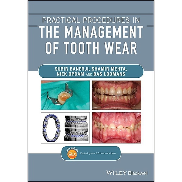 Practical Procedures in the Management of Tooth Wear, Subir Banerji, Shamir B. Mehta, Niek Opdam, Bas Loomans