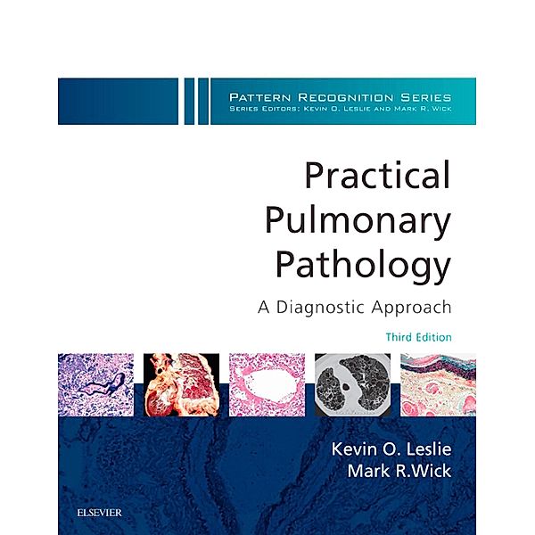 Practical Pulmonary Pathology: A Diagnostic Approach E-Book, Kevin O. Leslie, Mark R. Wick, Maxwell L. Smith